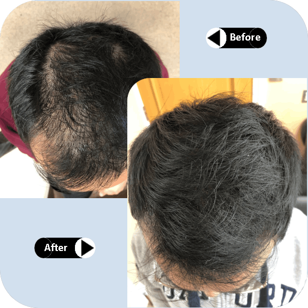 Side-by-side before and after photographs showing the top of a client's head