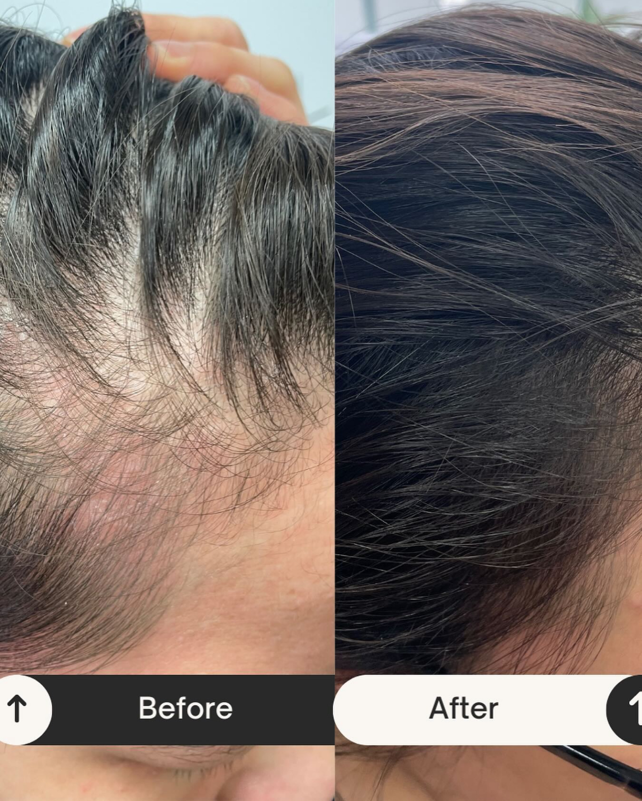 Side-by-side before and after photographs showing the front and side of a client's hair